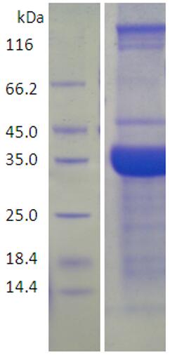 15% SDS-PAGE analysis profiles of purified KP1_4144-1-245 (CBB stained).